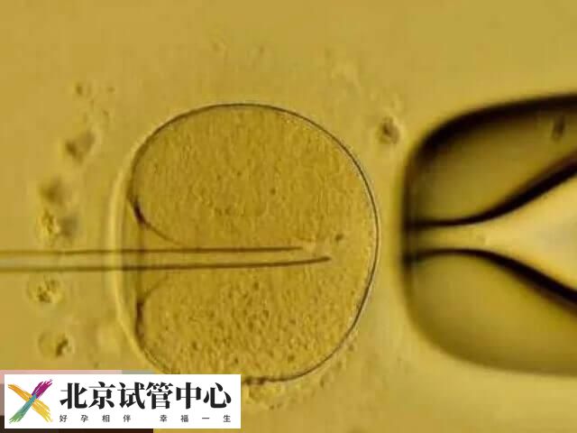单囊胚移植的优劣势分析，降低多胎妊娠风险是优点之一(图1)