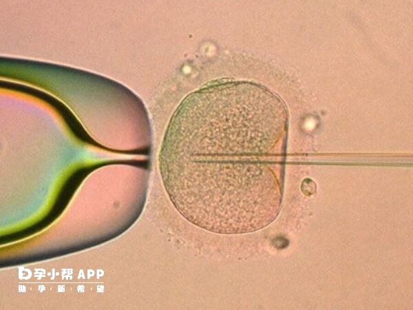 桥本甲状腺炎做试管比较好还是自然受孕好(图2)