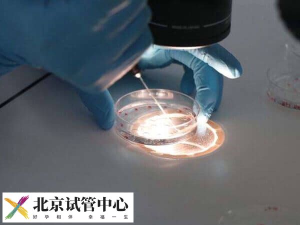 北京三代试管婴儿流程是怎样的(图2) 北京三代试管婴儿流程是怎样的(图2)